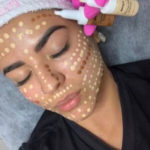 Tratamientos Dermapen BBGLOW